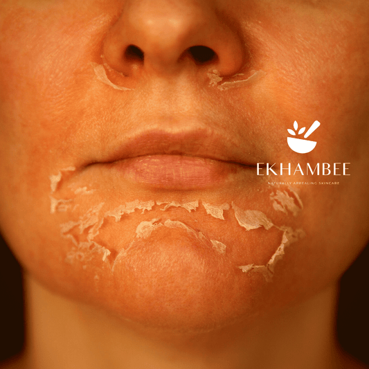 chemical peel on face