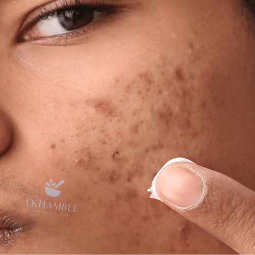 Small Brown Dots on Skin