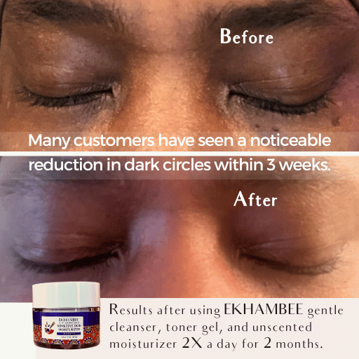 Eye Brightening Essentials