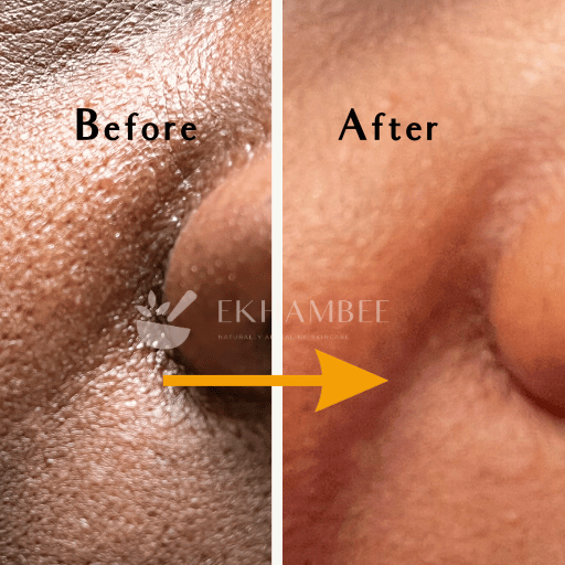 shrink pores fast | Ekhambee skin care